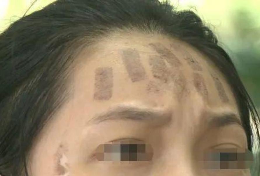 成都光子嫩膚價格，科技重塑肌膚之美